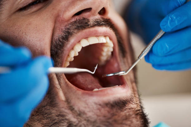 Best Broken Tooth Emergency  in Kingsport, TN